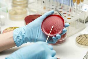 lab technician hand planting a petri dish photo