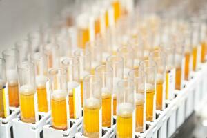 research in the laboratory, test tubes photo