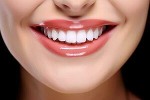 Beautiful woman smile. dental health background AI Generated photo