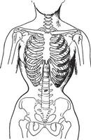 deformado por el corsés, demostración condición de huesos en mujer quien por costumbre vestir apretado corsés, Clásico grabado. vector
