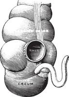 Diagram illustrating the union of the small intestines with the large, vintage engraving. vector