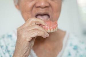 Asian elderly woman patient holding to use denture, healthy strong medical concept. photo