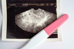 Pregnancy test with ultrasound scan of baby uterus, contraception health and medicine. photo