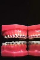 el tirantes son en el dientes en el artificial mandíbula en un negro antecedentes. de cerca foto