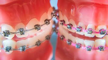 el tirantes son metido en el dientes en el artificial mandíbula. macro fotografía foto