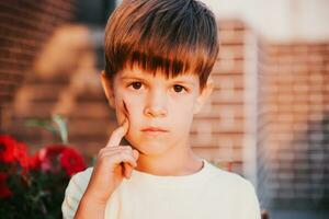 Portrait of a cute boy with a bruise on his face photo