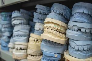 Warehouse of plaster models of human jaws in an orthodontic clinic. Control and diagnostic dental casts for aligners. photo