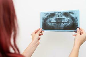 Dentist doctor checking dental x-ray orthopantomogram. Dental panoramic radiography photo