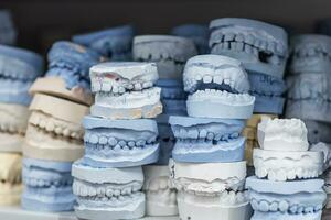 Warehouse of plaster models of human jaws in an orthodontic clinic. Control and diagnostic dental casts for aligners. photo