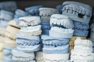 Warehouse of plaster models of human jaws in an orthodontic clinic. Control and diagnostic dental casts for aligners. photo