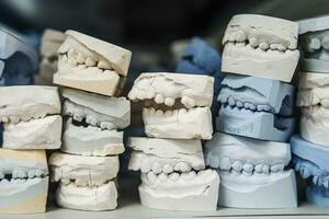 Warehouse of plaster models of human jaws in an orthodontic clinic. Control and diagnostic dental casts for aligners. photo