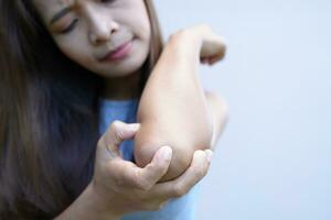 Asian woman has itching on her  arms. photo