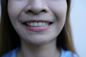 Asian woman smiling showing teeth photo