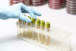 Test-tubes with yellow liquid in the laboratory photo