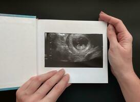 de cerca de hembra manos participación un cuaderno en cuales fotografía de un ultrasonido escanear de el feto foto