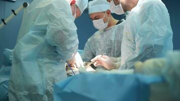 team van chirurgen aan het doen operatie in ziekenhuis video
