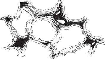 sección de pulmón demostración infiltración de el conectivo pañuelo de papel de el alveolar pared por polvo de carbón antracosis, Clásico grabado. vector