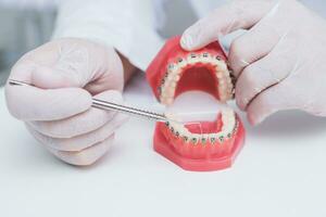 médico ortodoncista muestra cómo el sistema de tirantes en dientes es arreglado foto