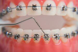 on macro photos shows how the system of brackets is arranged