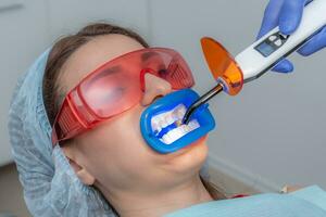 Preparing the oral cavity for whitening with an ultraviolet lamp. Close-up photo