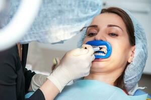 Preparing the oral cavity for whitening with an ultraviolet lamp. Close-up photo