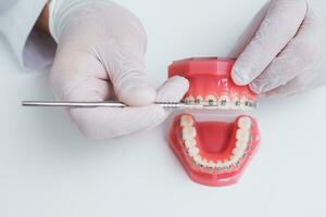 doctor orthodontist shows how the system of braces on teeth is arranged photo