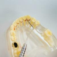 doctor orthodontist shows the instrument on caries in the teeth photo