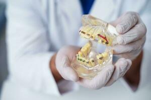 médico ortodoncista muestra cómo el sistema de tirantes en dientes es arreglado foto