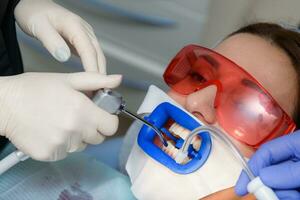 Preparing the oral cavity for whitening with an ultraviolet lamp. Close-up photo