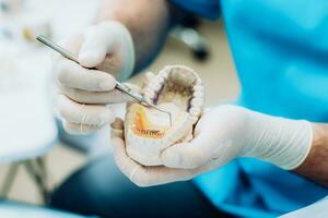 médico ortodoncista presentado cómo el plato trabajos a aplanar dientes en el mandíbulas foto