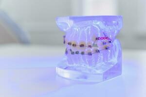 transparent artificial jaws with braces lie on the table photo