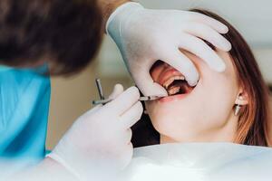 médico ortodoncista examina el oral cavidad de un hermosa paciente foto