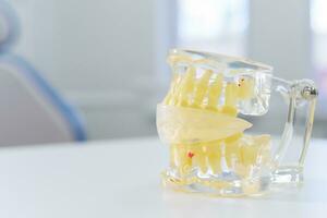 artificial transparent jaw lies on the table photo