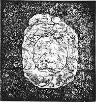 Calculation of sodium urate enchatonn in the bladder mucosa and vector