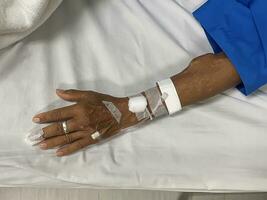 Arm of patients with kidney disease and diabetes. photo