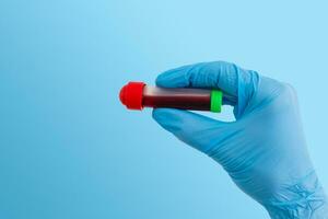 hand holding blood in test tube close up photo