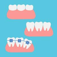 A set of teeth on a blue background. The concept of dental health. Dentistry icons. Vector. Flat style vector