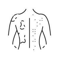 erupción piel lesiones enfermedad síntoma línea icono vector ilustración