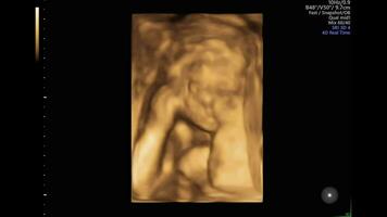 minúsculo hembra bebé rollos terminado en de la madre abdomen. bebé en matriz se mueve durante ultrasonido video