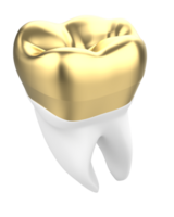 dent implant isolé sur Contexte. 3d le rendu- illustration png