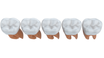 dente implantar isolado em fundo. 3d Renderização- ilustração png