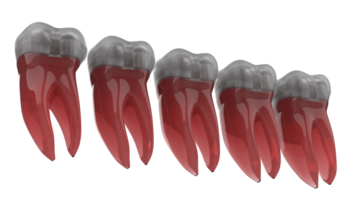 dente implantar isolado em fundo. 3d Renderização- ilustração png