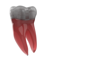 dente impiantare isolato su sfondo. 3d rendering- illustrazione png