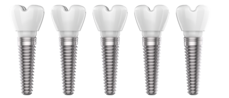 Tooth implant isolated on background. 3d rendering- illustration png