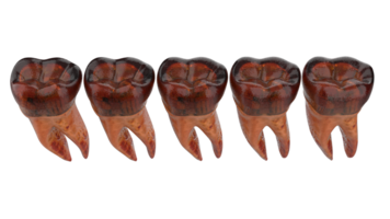 dente implantar isolado em fundo. 3d Renderização- ilustração png