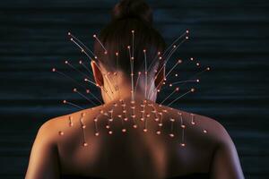AI generated Woman with red neuron on her back, concept of neurons and nervous system, Acupuncture needles in womans back, AI Generated photo