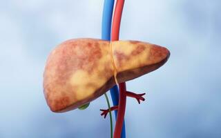 Liver organ with fatty liver state, 3d rendering. photo