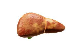 Liver organ with fatty liver state, 3d rendering. photo