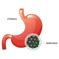 Norovirus in stomach vector illustration