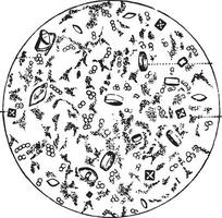 Some deposits in acid fermentation of the urine, vintage engraving. vector